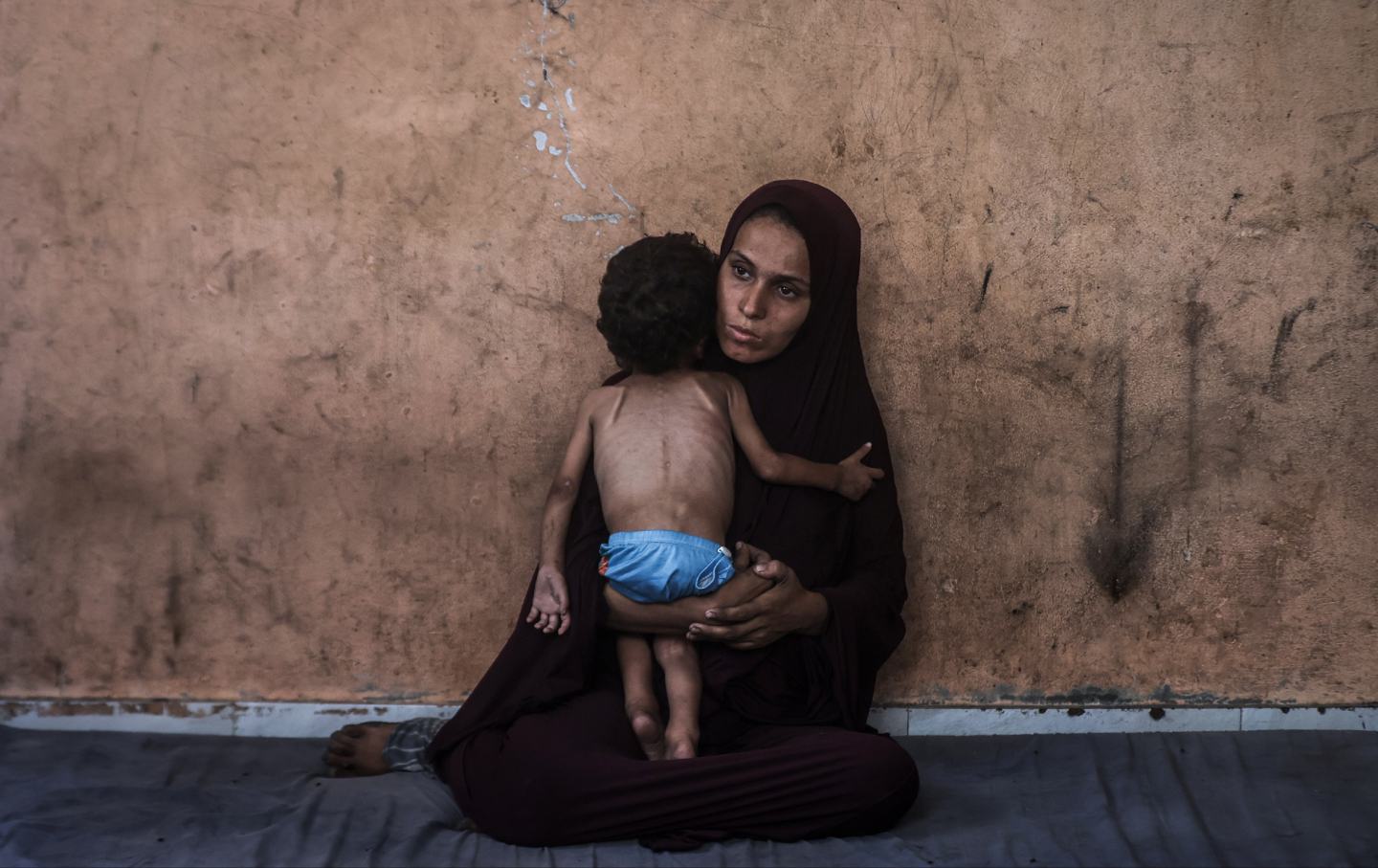 2-year-old Palestinian Yezen Abu Ful, whose health has deteriorated due to lack of access to food and nutritional supplements, is seen with his mother in the Al-Shati Refugee Camp in Gaza Strip on July 24, 2025.