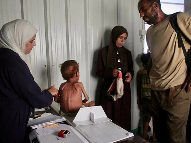 a malnourished palestinian child gets a check up at a medical point run by a local ngo affiliated with the primary health care of the palestinian health ministry in al mawasi in the southern gaza strip district of khan yunis on august 13 2025 afp
