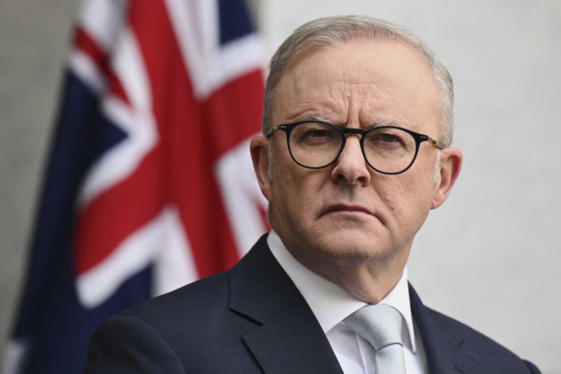 Australian Prime Minister Anthony Albanese speaks to the media during a press conference at Parliament House in Canberra, Australia, Tuesday, Aug. 26, 2025.