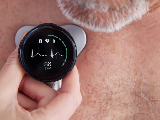 the ai stethoscope uses a card sized sensor and microphone to detect heart sounds and blood flow beyond human hearing photo eko health