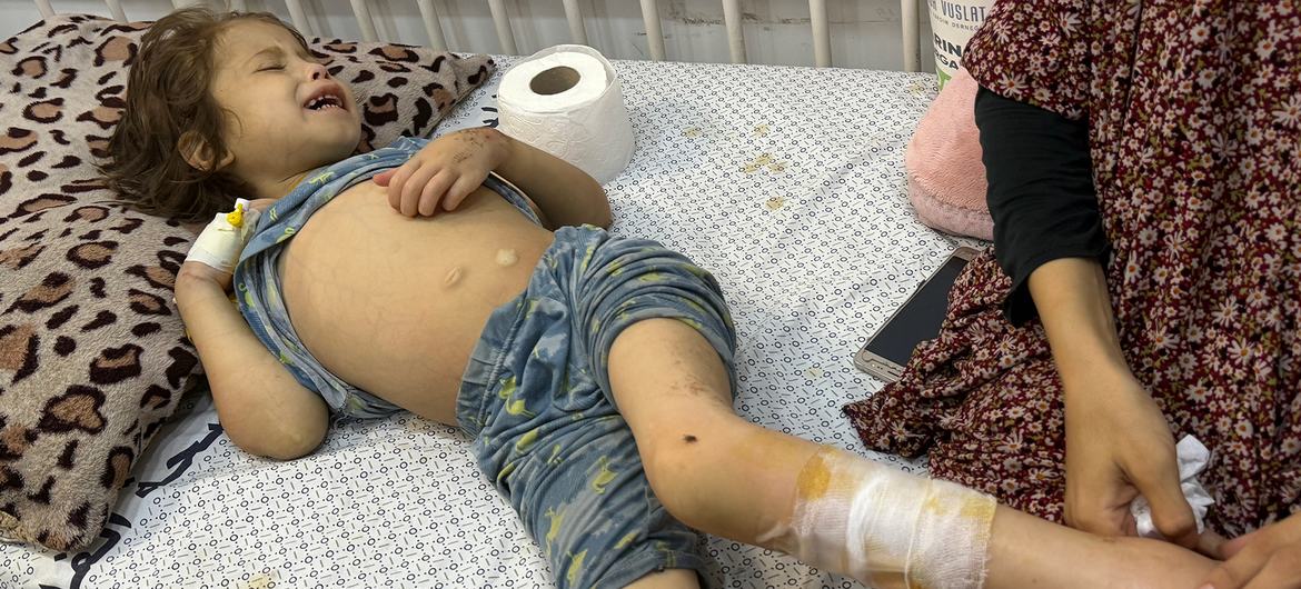 Seven-year-old Janah is treated at Gaza City’s Patient Friendly Hospital.