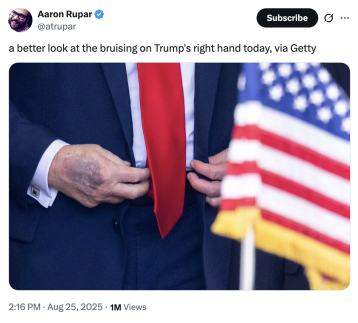 Aaron Rupar @atrupar Subscribe ... a better look at the bruising on Trump
