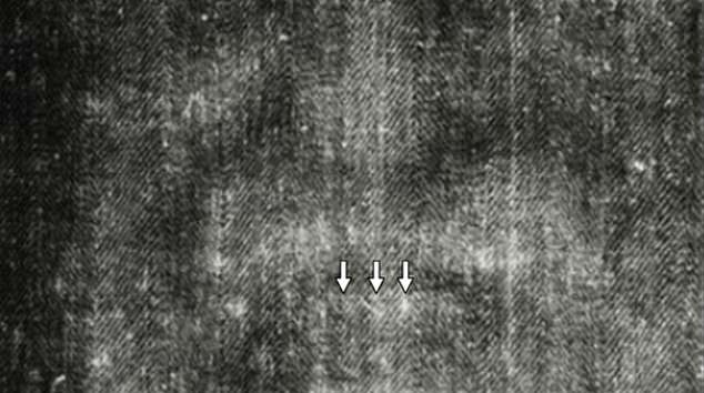 A dental surgeon says there are visible teeth on the Shroud. Dr John Sottosanti believes the teeth were a result of the resurrection just as the image of the human body