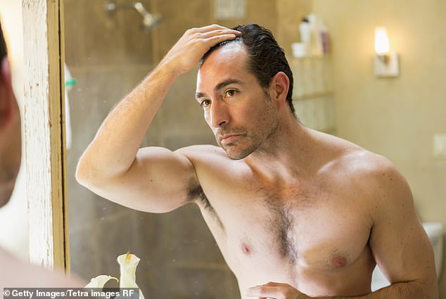 About two-thirds of men in the US experience some form of hair loss before the age of 35 years, estimates suggest (stock image)