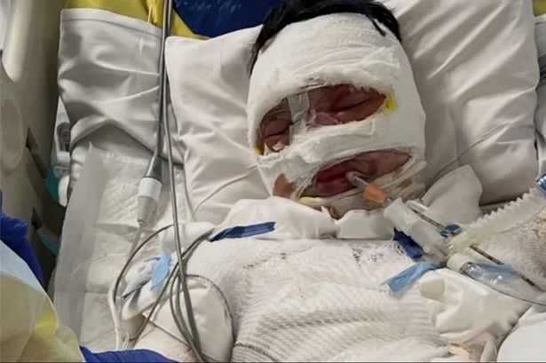 Jacob was flown to Sydney and placed into an induced coma on life support